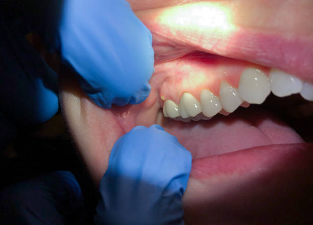 Best Pediatric Emergency Dentist in Towanda, PA